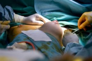 la-chirurgie-esthetique