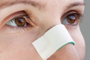 rhinoplastie-septoplastie